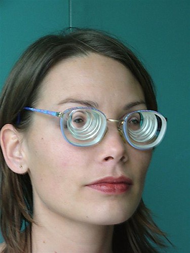 兰州普瑞眼科医院专家：植入眼睛内部的隐形眼镜矫正近视